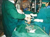 Caesarean surgery in Tamil Nadu